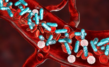 Visual representation of sepsis with blue, pink and red items in blood vessels 